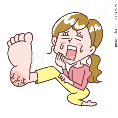 一個令人震驚的腳底破裂的女人 83747079