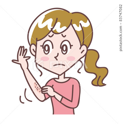 A woman with dry and itchy arms 83747082