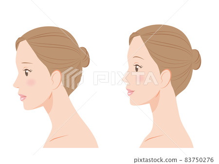 直脖子的女人 直脖子的女人 83750276