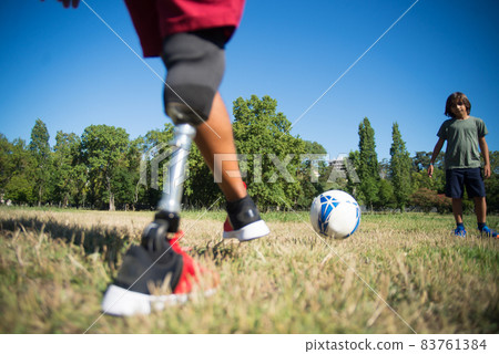 Father with prosthetic leg playing football with son 83761384