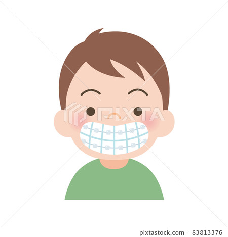 用不起眼的矯治器矯正牙列的男孩 83813376