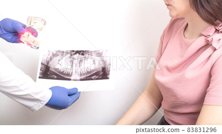 Doctor dentist holds a panoramic x-ray picture and a mock-up of the human dental jaw Concept of acute toothache, gingivitis, close-up Doctor dentist holds a panoramic x-ray picture and a mock-up of the human dental jaw Concept of acute toothache, gingivitis, close-up 83831296