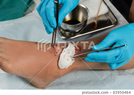 close up doctor cleaning wound on leg, Injuries from falling close up doctor cleaning wound on leg, Injuries from falling 83950464