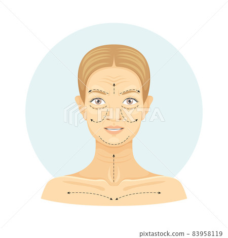 Cosmetic surgery on female face with dotted lines. Plastic surgery vector illustration 83958119