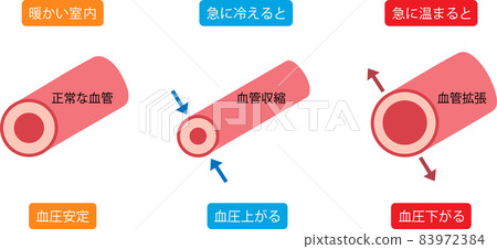 Heat shock vasoconstriction vasodilation 83972384