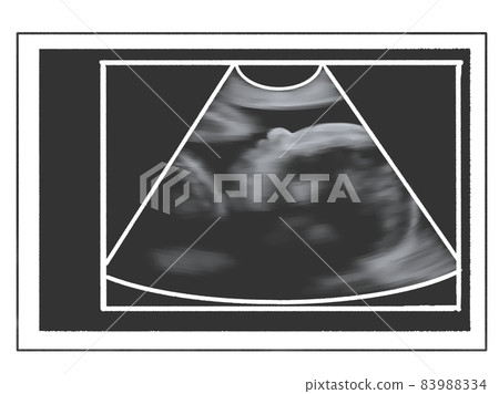 Echo photo style illustration (late pregnancy) 83988334