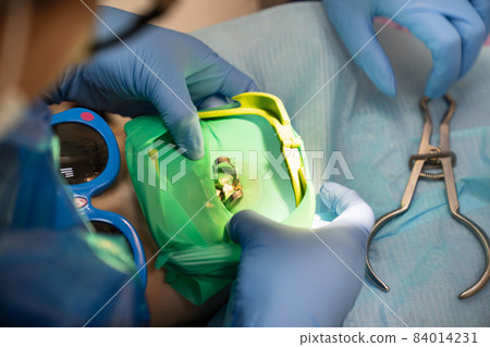 the dentist uses Cofferdam for the treatment of a child 84014231