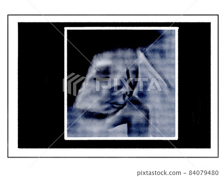 3D echo photo style illustration of late pregnancy (foetation wearing a cheek cane) 3D echo photo style illustration of late pregnancy (foetation wearing a cheek cane) 84079480