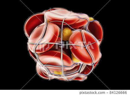 3d Illustration of Deep Vein Thrombosis or Blood Clots. Embolism, clipping path included 84126666