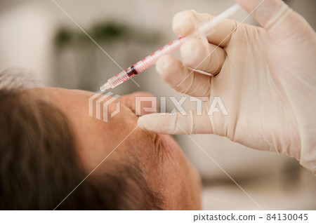 Soft focus on a syringe with beauty product on the beautician hands in white surgical gloves making injection on the face of middle aged man for rejuvenation and anti-aging treatment in wellness spa 84130045