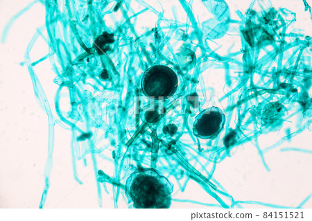 Characteristics of Rhizopus is a genus of common saprophytic fungi on Slide under the microscope for education. Characteristics of Rhizopus is a genus of common saprophytic fungi on Slide under the microscope for education. 84151521