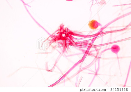 Characteristics of Rhizopus is a genus of common saprophytic fungi on Slide under the microscope for education. Characteristics of Rhizopus is a genus of common saprophytic fungi on Slide under the microscope for education. 84151538