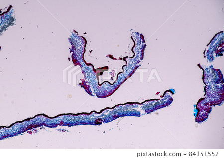Characteristics of Lichen, hyphae and Symbiotic algae under the microscope for education. Characteristics of Lichen, hyphae and Symbiotic algae under the microscope for education. 84151552
