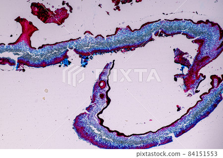 Characteristics of Lichen, hyphae and Symbiotic algae under the microscope for education. 84151553