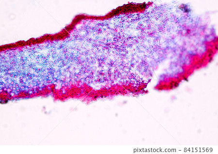 Characteristics of Lichen, hyphae and Symbiotic algae under the microscope for education. 84151569
