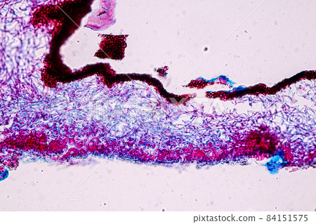 Characteristics of Lichen, hyphae and Symbiotic algae under the microscope for education. 84151575