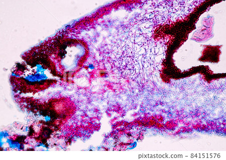 Characteristics of Lichen, hyphae and Symbiotic algae under the microscope for education. Characteristics of Lichen, hyphae and Symbiotic algae under the microscope for education. 84151576