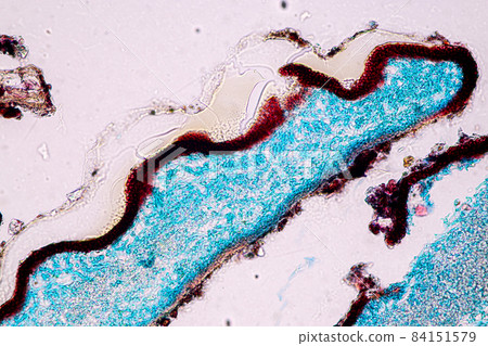 Characteristics of Lichen, hyphae and Symbiotic algae under the microscope for education. Characteristics of Lichen, hyphae and Symbiotic algae under the microscope for education. 84151579