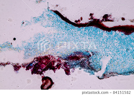 Characteristics of Lichen, hyphae and Symbiotic algae under the microscope for education. Characteristics of Lichen, hyphae and Symbiotic algae under the microscope for education. 84151582
