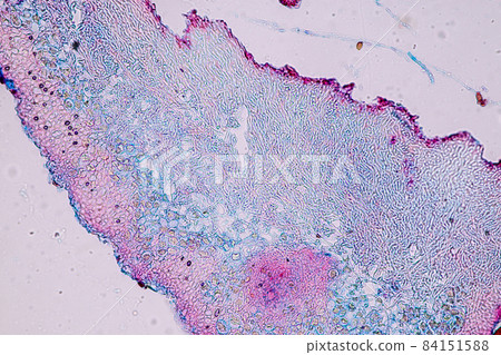 Characteristics of Lichen, hyphae and Symbiotic algae under the microscope for education. Characteristics of Lichen, hyphae and Symbiotic algae under the microscope for education. 84151588