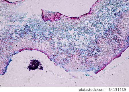 Characteristics of Lichen, hyphae and Symbiotic algae under the microscope for education. Characteristics of Lichen, hyphae and Symbiotic algae under the microscope for education. 84151589