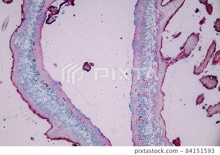 Characteristics of Lichen, hyphae and Symbiotic algae under the microscope for education. Characteristics of Lichen, hyphae and Symbiotic algae under the microscope for education. 84151593