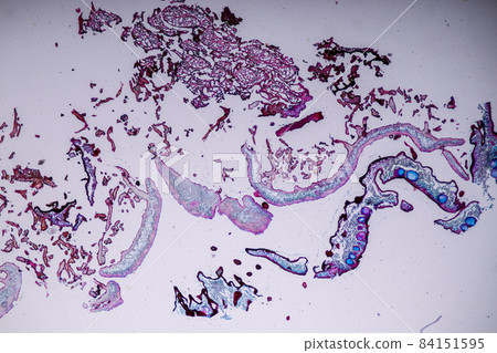 Characteristics of Lichen, hyphae and Symbiotic algae under the microscope for education. 84151595