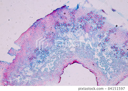 Characteristics of Lichen, hyphae and Symbiotic algae under the microscope for education. Characteristics of Lichen, hyphae and Symbiotic algae under the microscope for education. 84151597