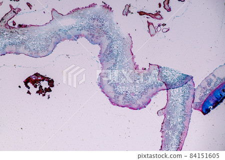 Characteristics of Lichen, hyphae and Symbiotic algae under the microscope for education. 84151605
