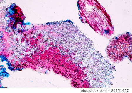 Characteristics of Lichen, hyphae and Symbiotic algae under the microscope for education. Characteristics of Lichen, hyphae and Symbiotic algae under the microscope for education. 84151607