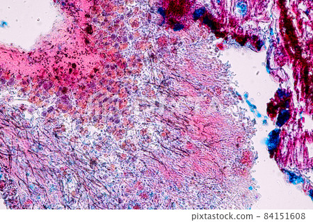 Characteristics of Lichen, hyphae and Symbiotic algae under the microscope for education. 84151608