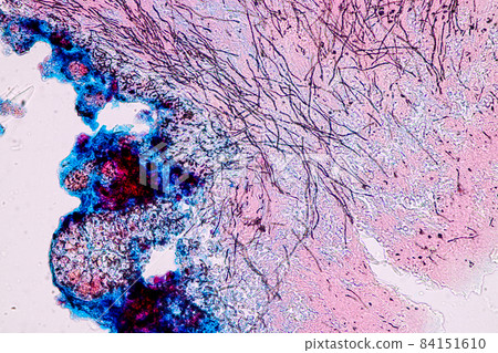 Characteristics of Lichen, hyphae and Symbiotic algae under the microscope for education. 84151610