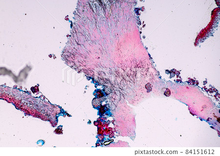 Characteristics of Lichen, hyphae and Symbiotic algae under the microscope for education. Characteristics of Lichen, hyphae and Symbiotic algae under the microscope for education. 84151612
