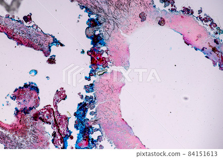 Characteristics of Lichen, hyphae and Symbiotic algae under the microscope for education. Characteristics of Lichen, hyphae and Symbiotic algae under the microscope for education. 84151613
