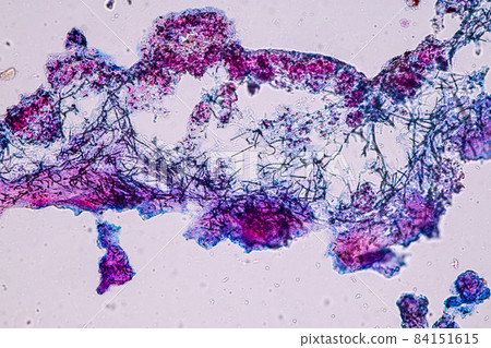 Characteristics of Lichen, hyphae and Symbiotic algae under the microscope for education. Characteristics of Lichen, hyphae and Symbiotic algae under the microscope for education. 84151615