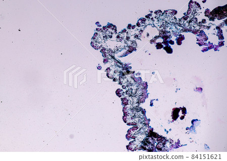 Characteristics of Lichen, hyphae and Symbiotic algae under the microscope for education. Characteristics of Lichen, hyphae and Symbiotic algae under the microscope for education. 84151621