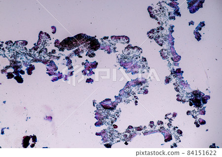 Characteristics of Lichen, hyphae and Symbiotic algae under the microscope for education. Characteristics of Lichen, hyphae and Symbiotic algae under the microscope for education. 84151622