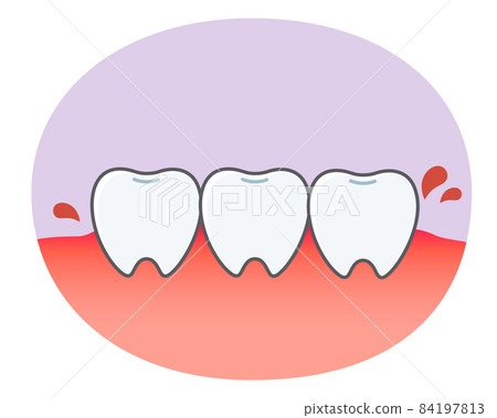 牙周牙齒和牙齦的可愛插圖 84197813