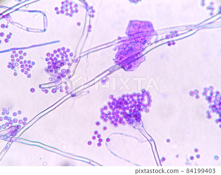 Penicillium conidia microscopic observation 84199403