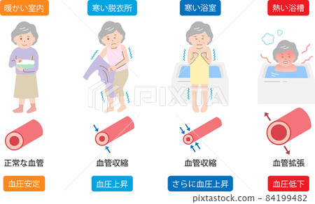 Heat shock Senior female vasoconstriction and vasodilation Increased blood pressure and decreased blood pressure 84199482