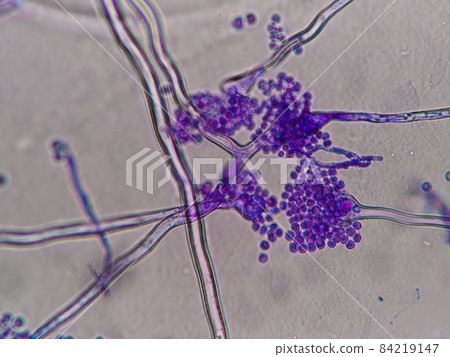 Aspergillus spore micrograph 84219147
