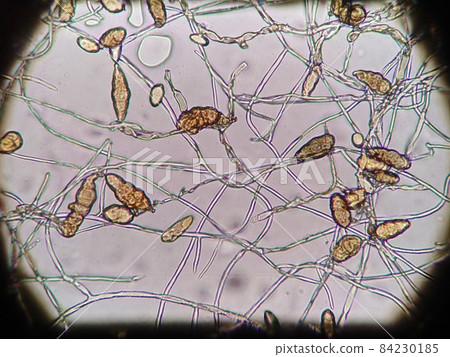 Susukabi 的顯微照片 84230185