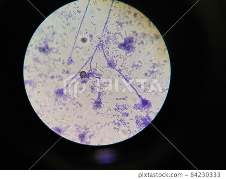青霉的菌絲體頂端附著很多孢子 84230333