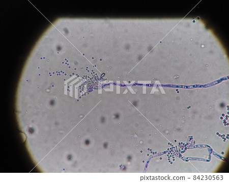 聚焦模具骨架的顯微照片 84230563