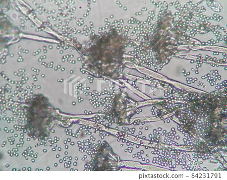 Micrograph of blue mold 84231791