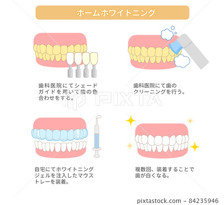 Home whitening Illustration of tooth whitening 84235946