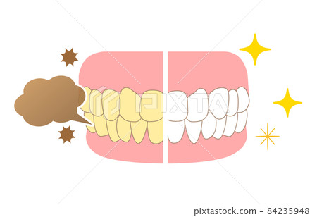 牙齒著色和美白 84235948