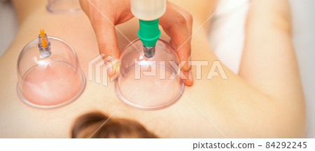 Woman receiving vacuum cupping treatment on back laying on the chest in massage salon. 84292245