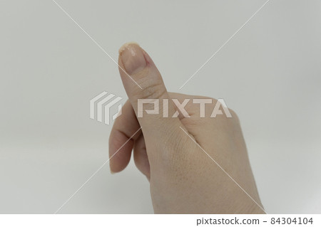 破裂的指甲 84304104