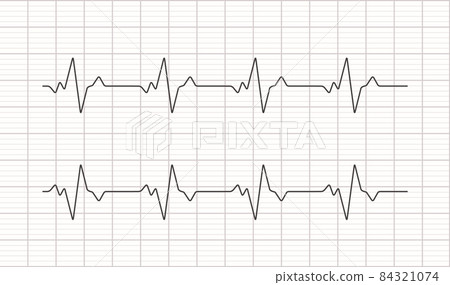Heartbeat ecg electrocardiogram vector graph wave line. Ekg cardio heart beat cardiology frequency 84321074
